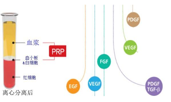 PDGF：血小板衍生生长因子.jpg