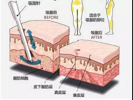 微信图片_20180410094932.jpg