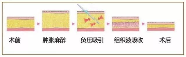 微信图片_20180410094915.jpg