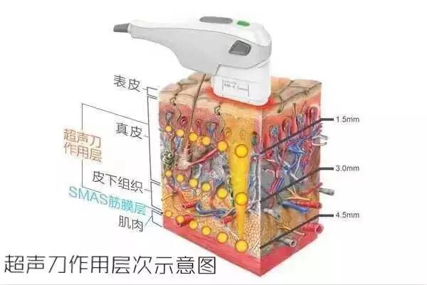 微信图片_20180410100936.jpg