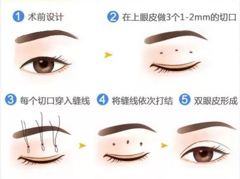 微信图片_20180414124958.jpg