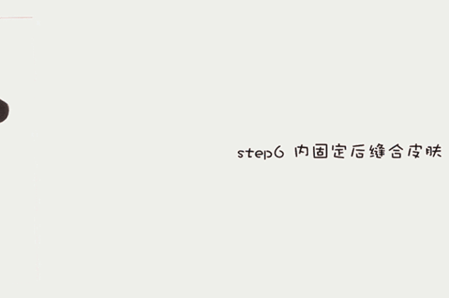 微信图片_20180424135535.gif