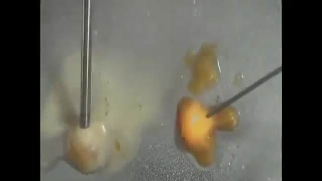 新型Z波黄金脂雕Vs传统镭射溶脂