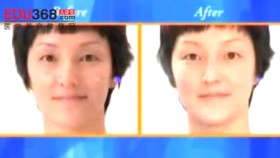 美容医学紧肤嫩肤