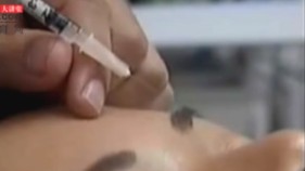 肉毒杆菌毒性强 1公克即致命