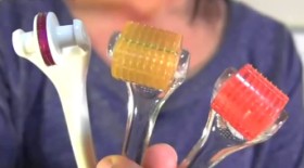 如何使用微针滚轮祛除痤疮疤痕？