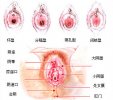 处女膜修复术　人生若只如初夜