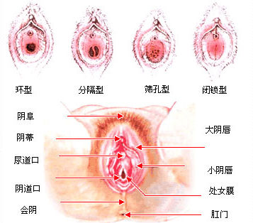 处女膜示意图