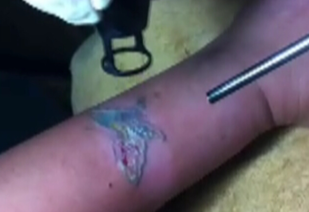 专业洗纹身操作演示