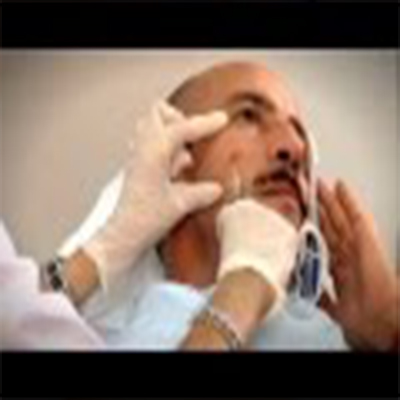 Restylane Vital填充面部3